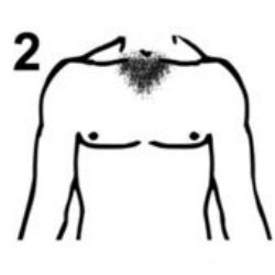 #2
