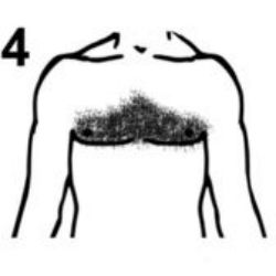 #4