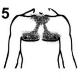 #5