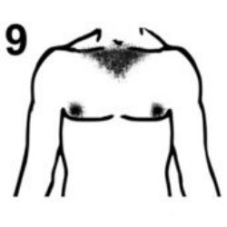 #9