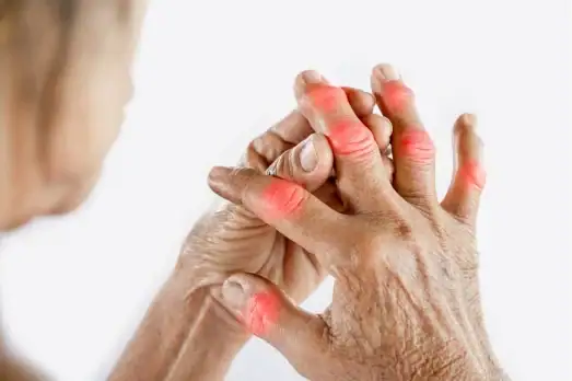 Joint and arthritis therapy