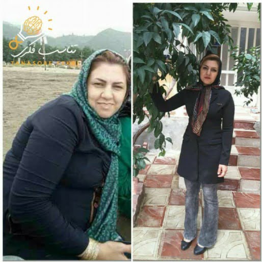 نتیجه دوره لاغری با ذهن - شگفتی‌ساز ۲
