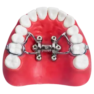 MSE Expander