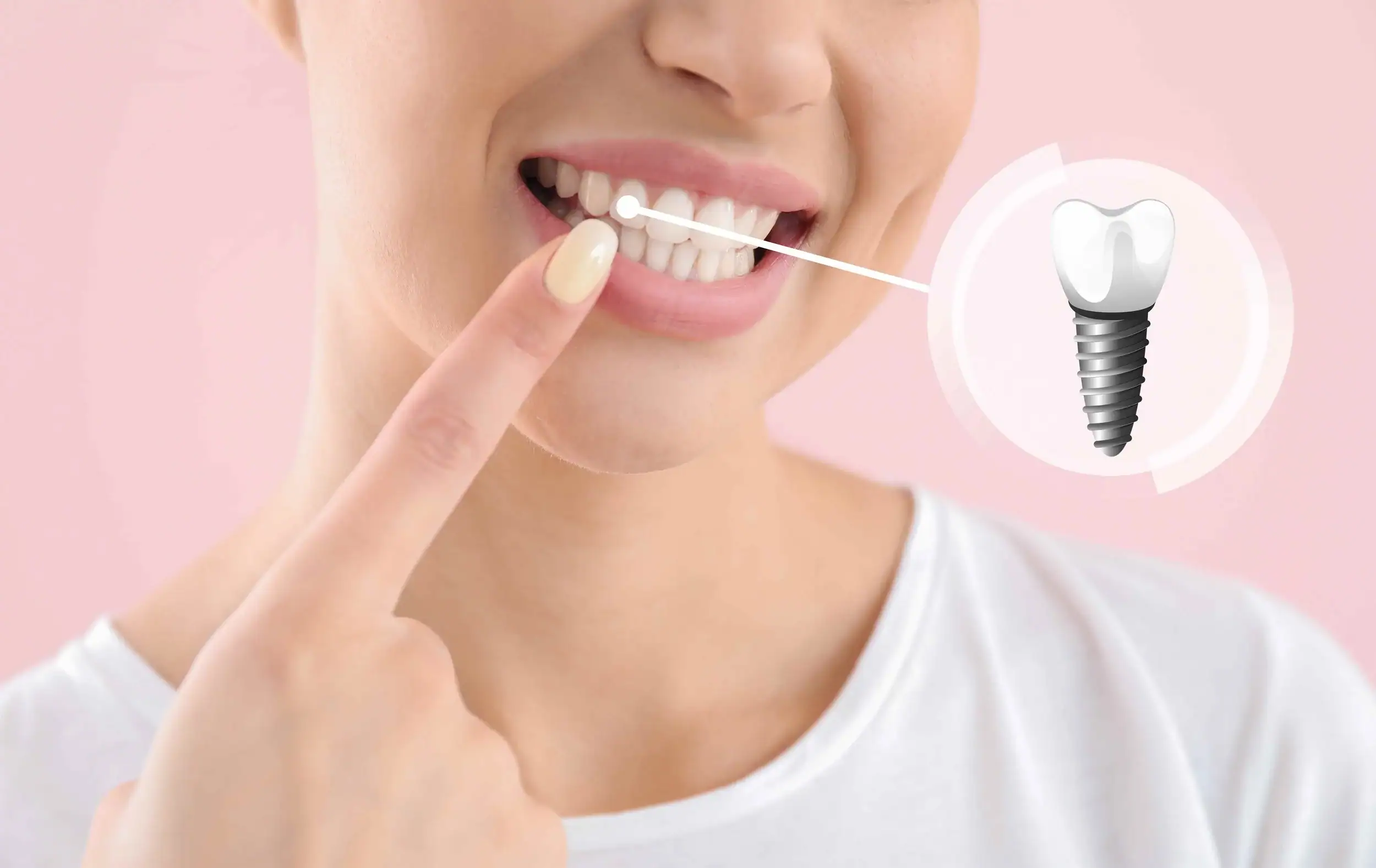 Advanced digital planning technology for precise dental implant placement