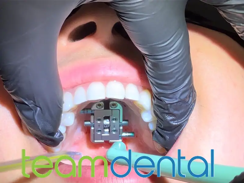 Sleep Apnea and Airway Therapy
