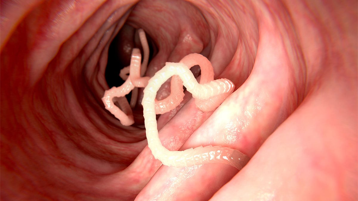 white-parasitic-worm-inside-a-colon