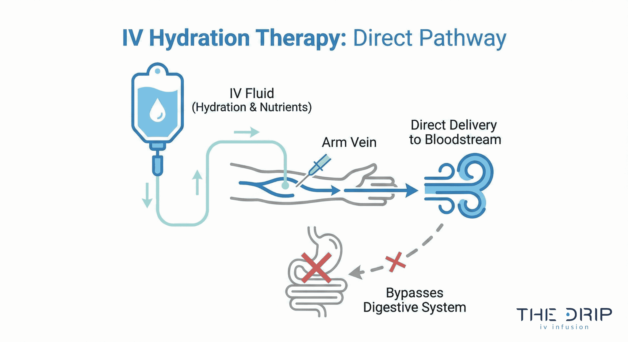 Diagram showing IV hydration bypassing digestive system and going directly into bloodstream.