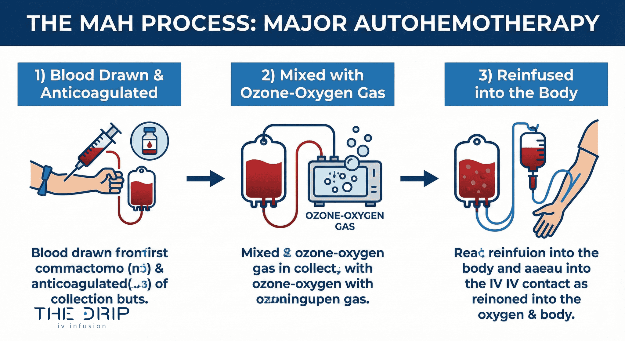 Diagram showing how blood is treated with ozone and reinfused during MAH.
