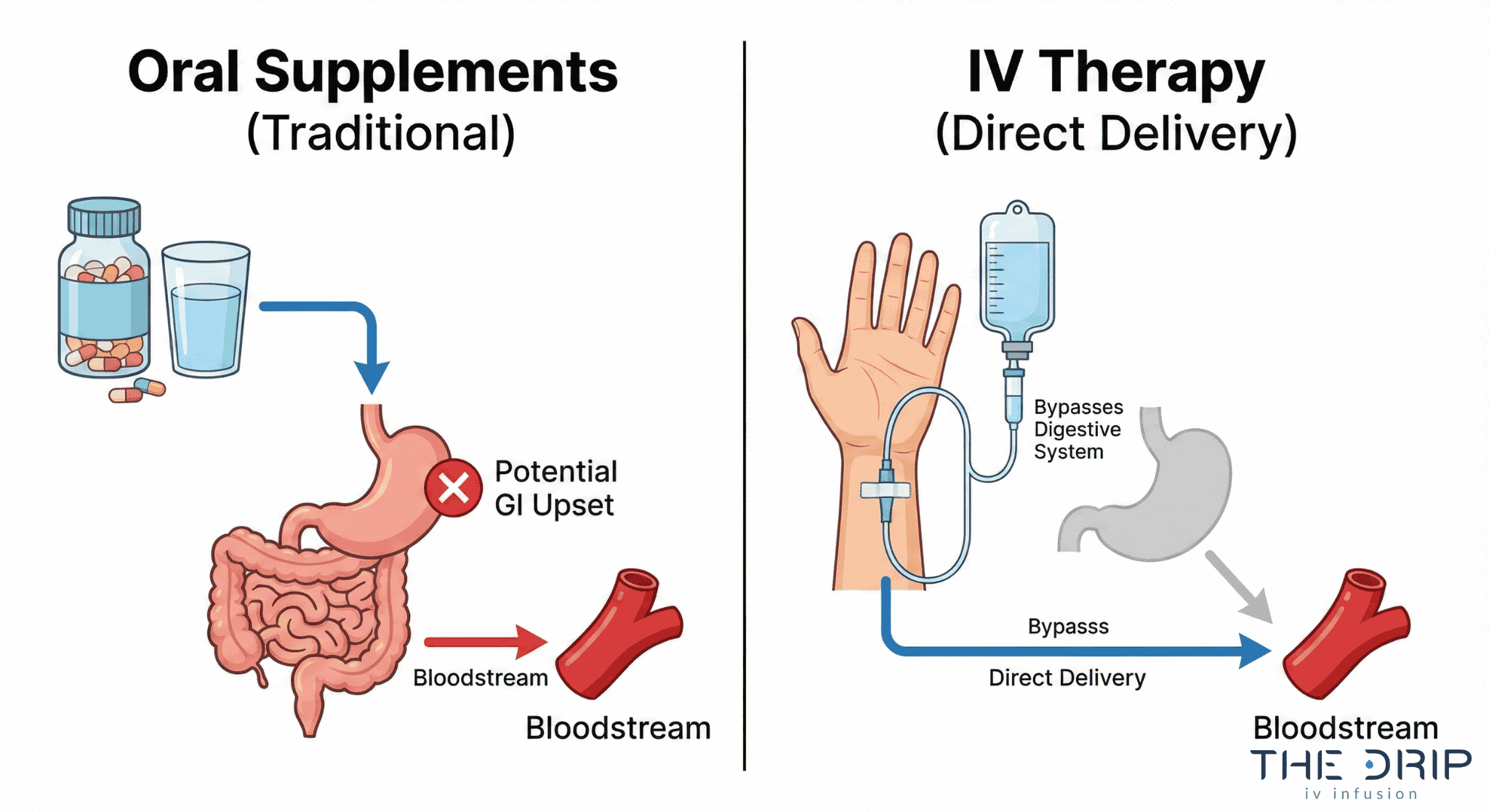 Infographic comparing oral supplement digestion route with IV therapy bloodstream delivery.