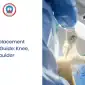 joint replacement surgery 85x85