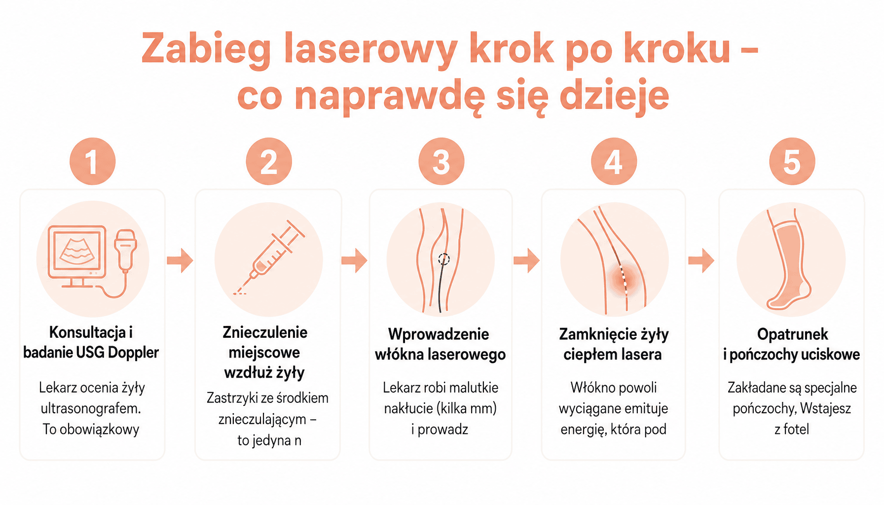 Laserowe usuwanie żylaków opinie: 5 kroków zabiegu EVLT dla początkujących pacjentek