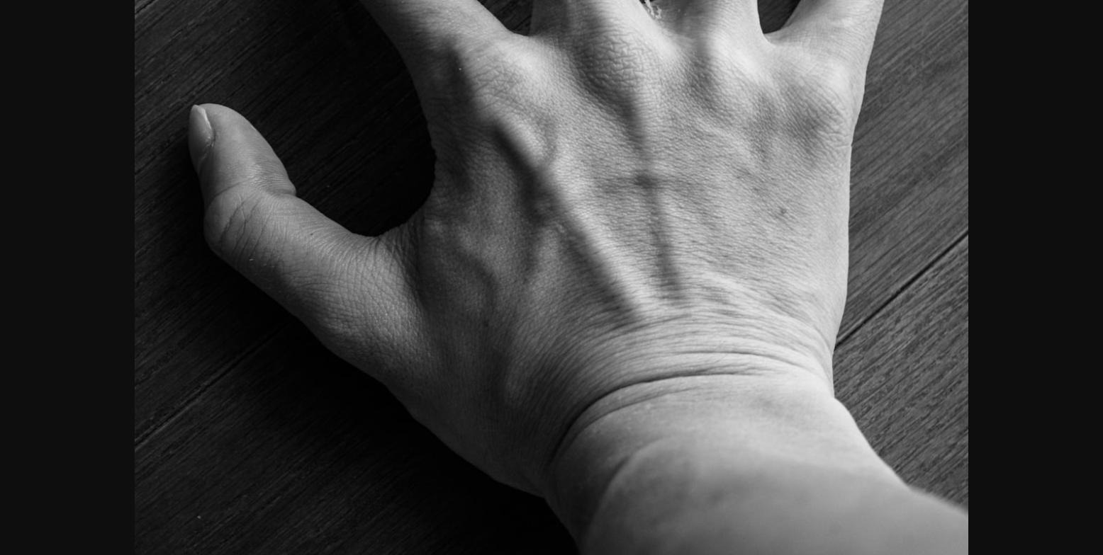 Ganglion cyst hand wrist surgery Austin TX ATX Orthopedics