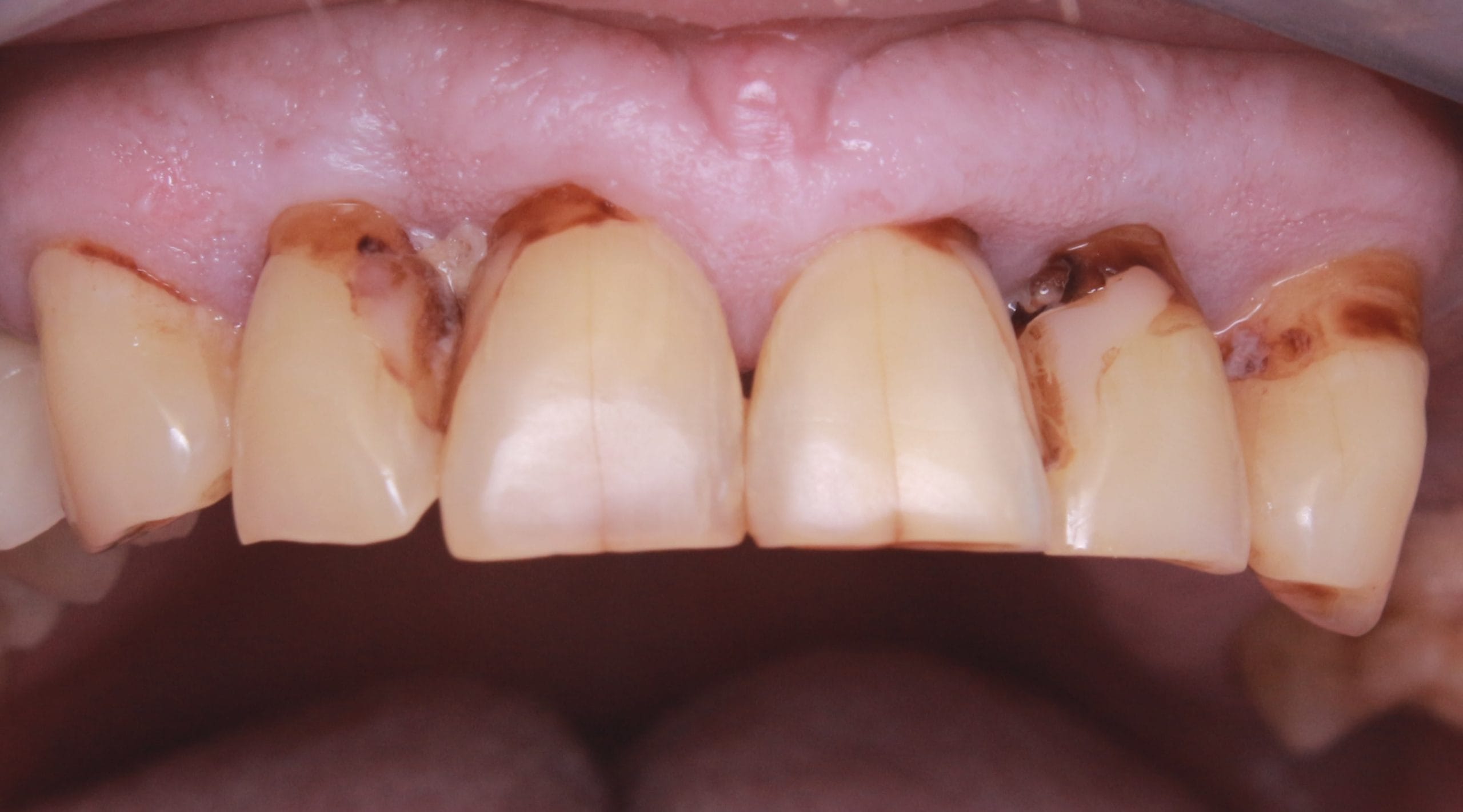 Before image
