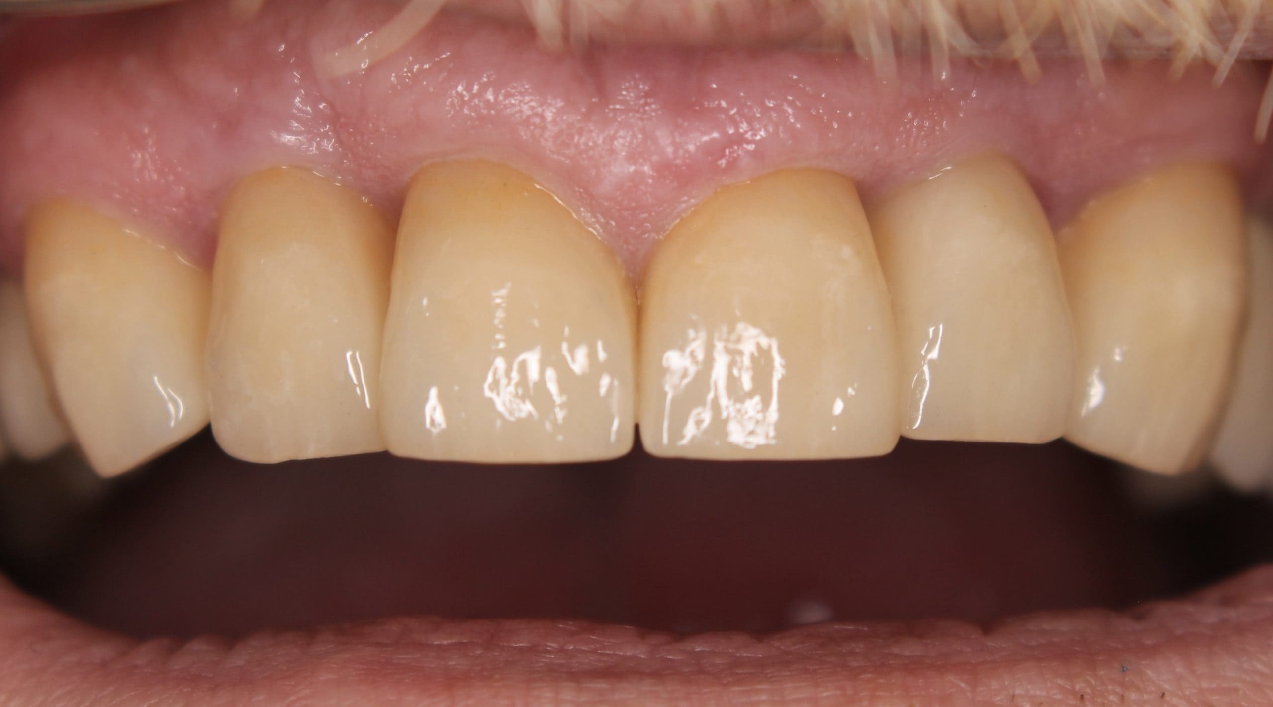 After image