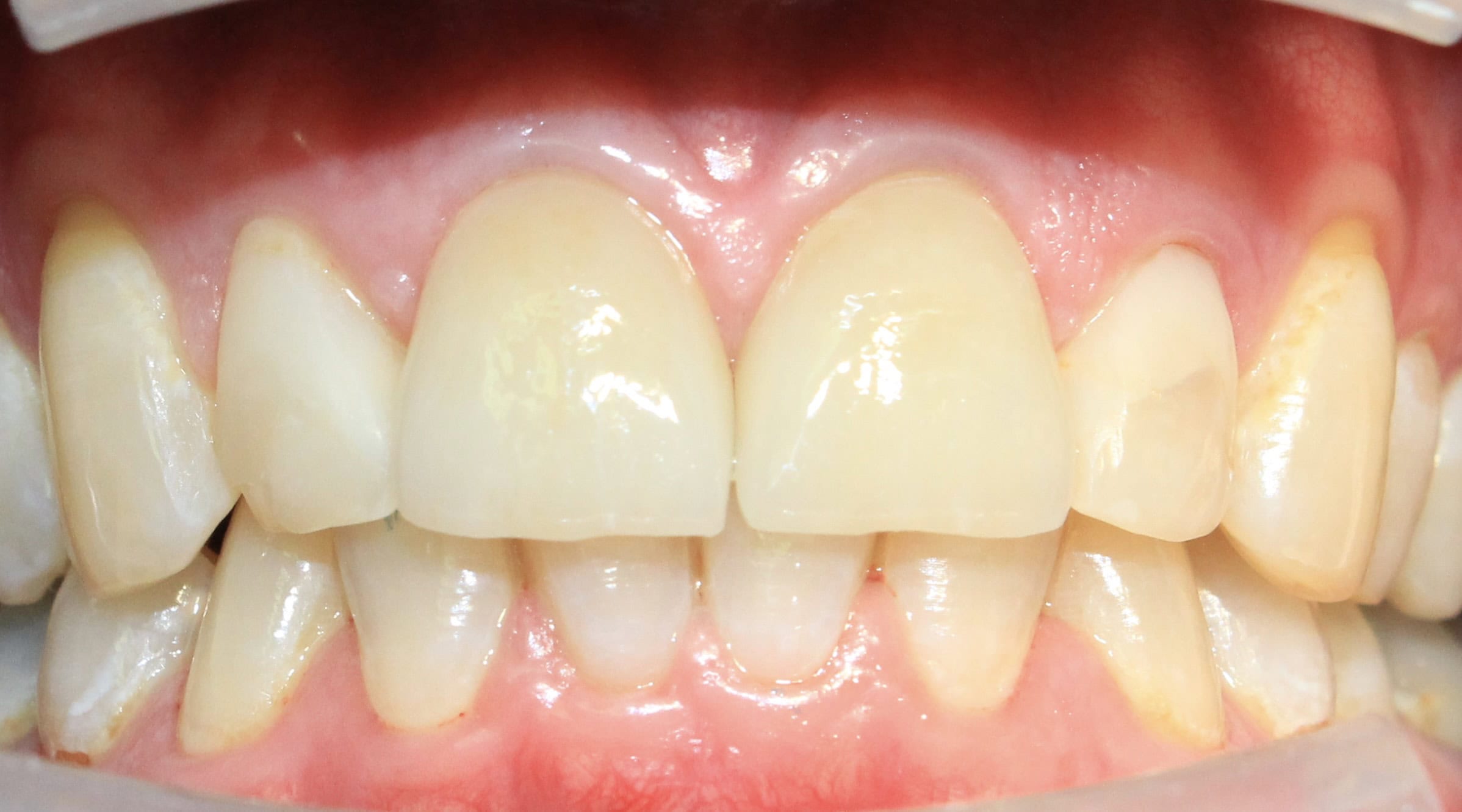 After image