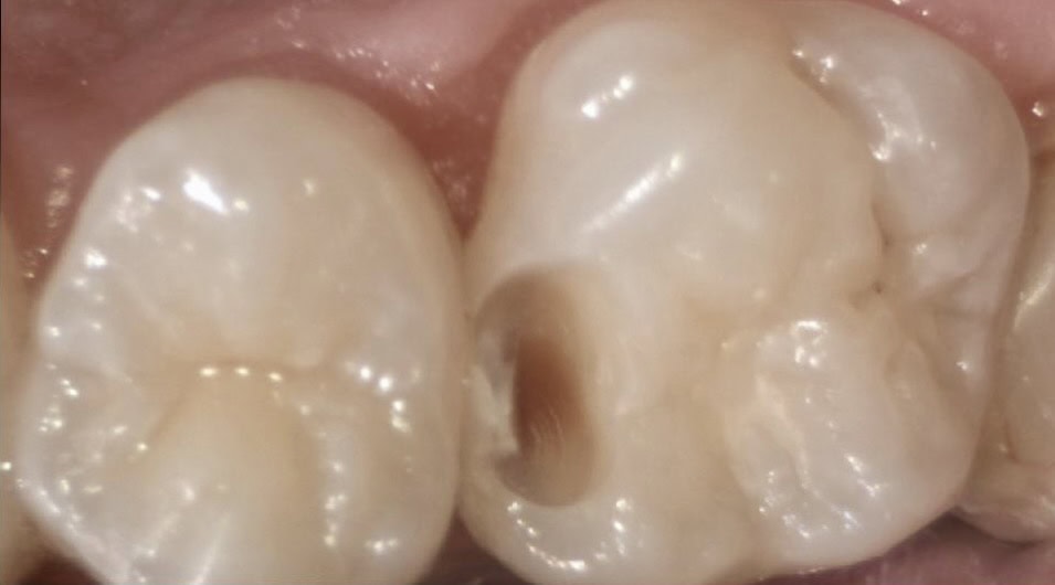 Before image