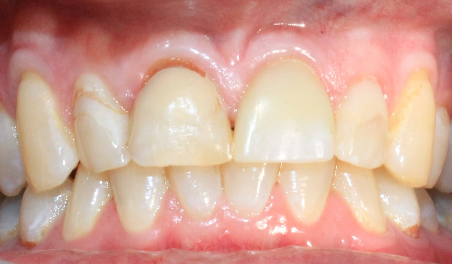 Before image