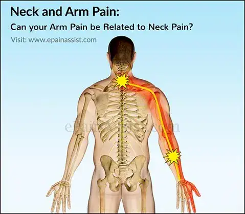Neck and arm pain relief Honolulu, HI