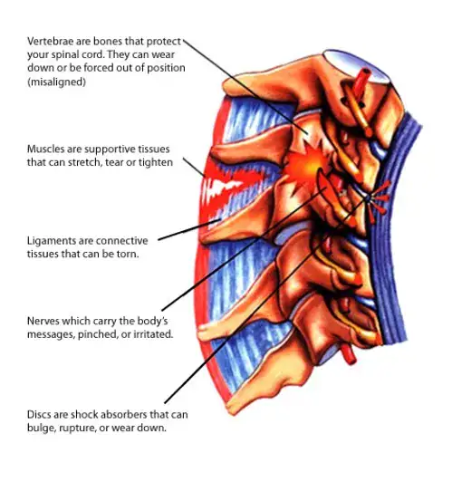 Diagram of vertebrae