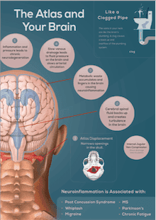 Brain diagram