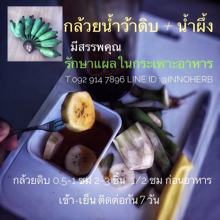 การใช้กล้วยน้ำว้าดิบรักษาแผลในกระเพาะอาหาร