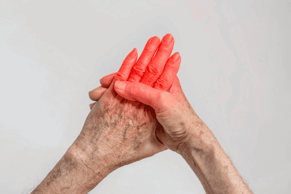 Burning or Shock-like sensation