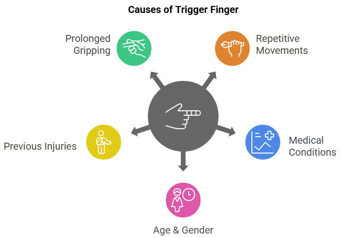 Causes of trigger finger