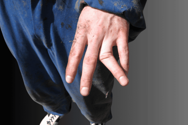 Dislocations