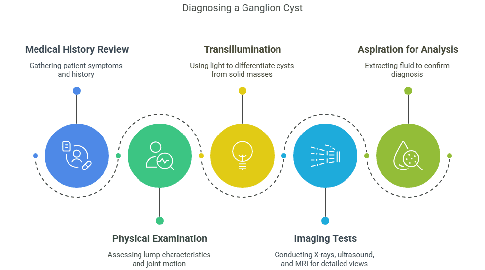 How is ganglion cyst diagnosed