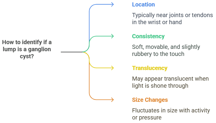 How to identify if a lump is a ganglion cyst