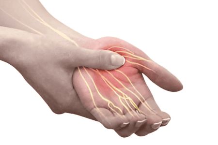 Peripheral nerve injuries & Compressive neuropathies