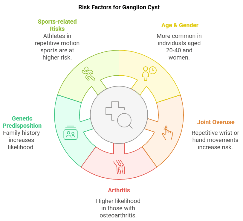 Risk factors of ganglion cyst