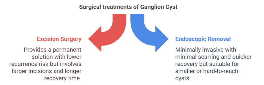 Surgical treatments of Ganglion Cyst