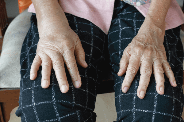 Swollen or Stiff fingers