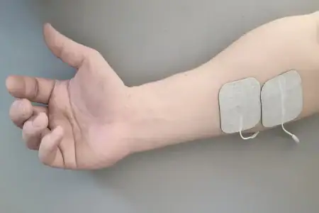 Ultrasound & Electrical stimulation therapy
