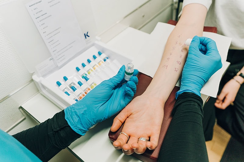allergie-test-tzimas Allergie