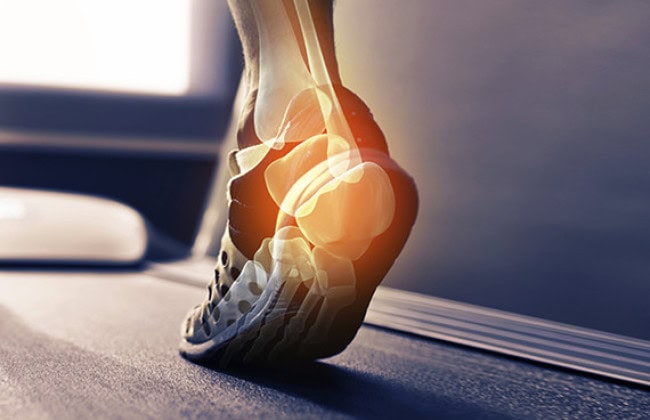 orthotics brisbane orthotics experts