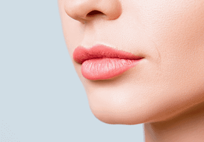 Lip Lift (Dudak Kaldırma) Ameliyatı