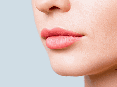 Lip Lift (Dudak Kaldırma) Ameliyatı