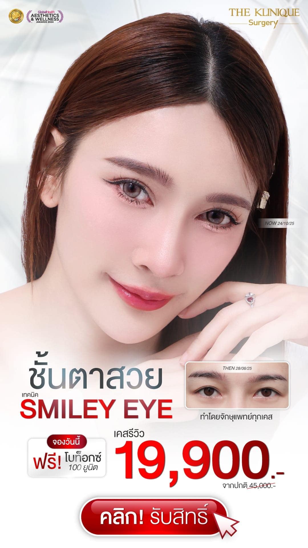 ตาสองชั้น” style=