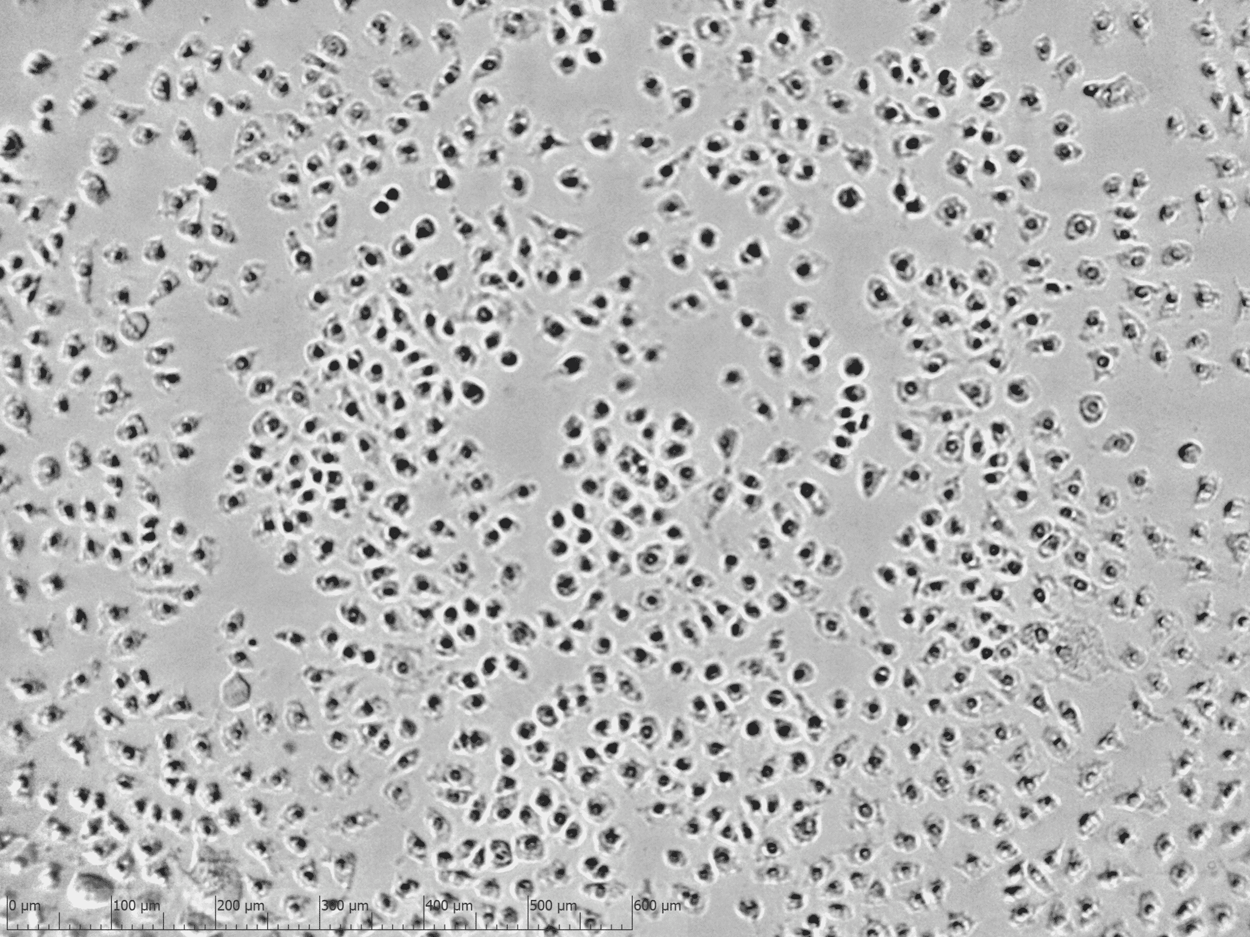 Cytotoxicity assay live cell imaging with zenCELL owl incubator microscope