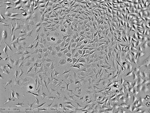 L929 fibroblast untreated control — zenCELL owl brightfield imaging