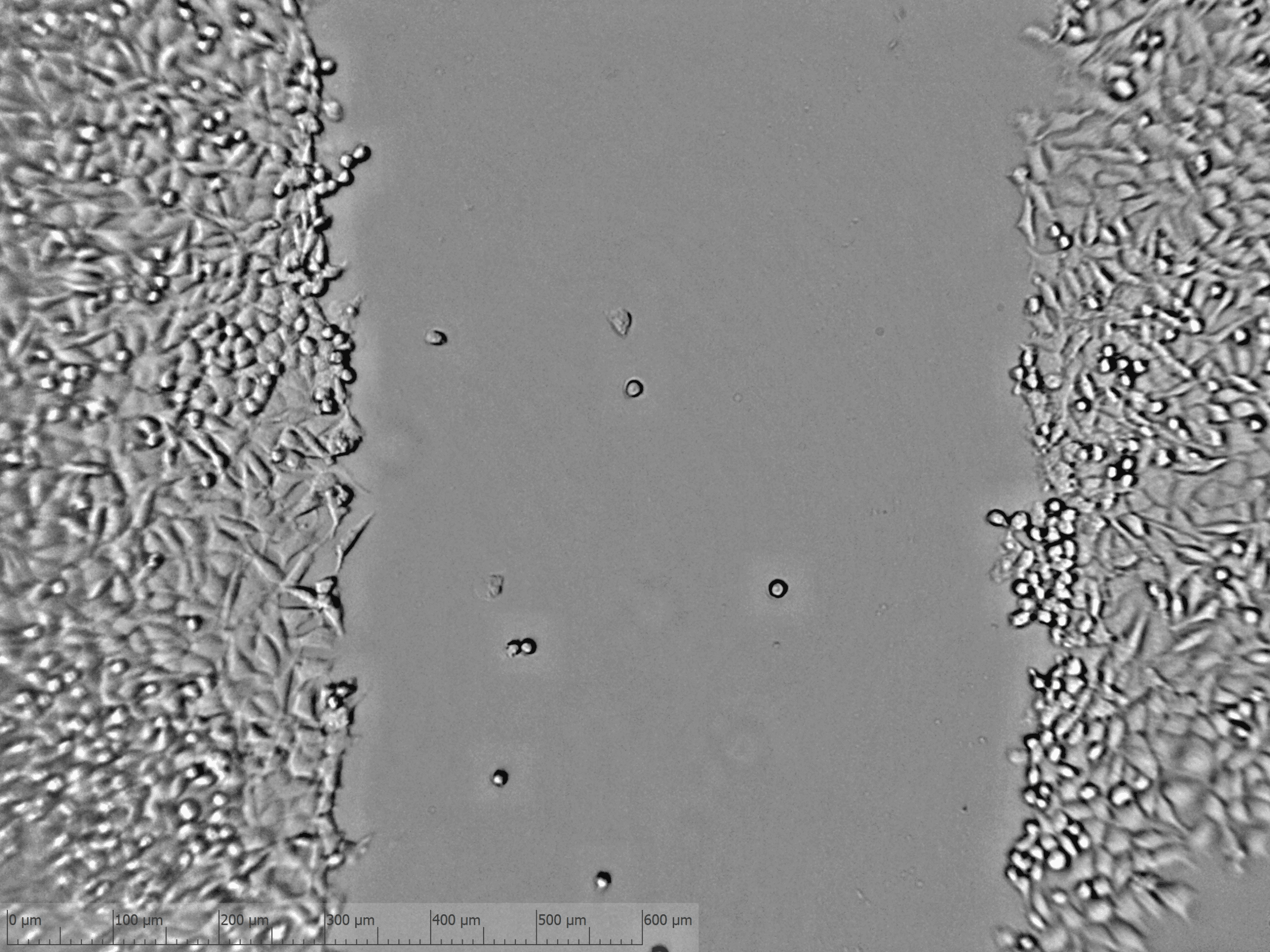 Image of scratch assay wound at T=0 captured with zenCELL owl – clean wound edges with defined geometry using ScratchMaker scratch assay plates