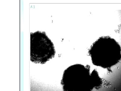 Koala oocyte imaged with zenCELL owl IVF software — brightfield live cell imaging