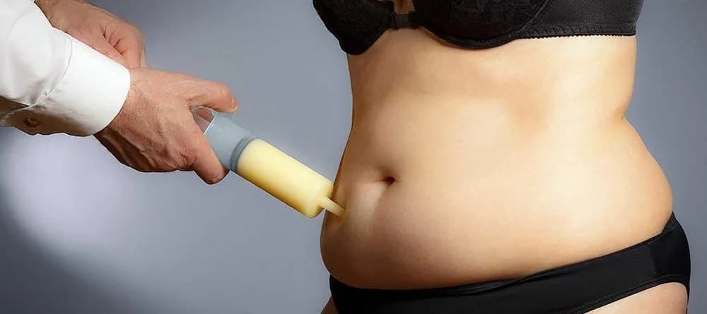 You are currently viewing How Soon Can You Have Liposuction After Having a Baby?