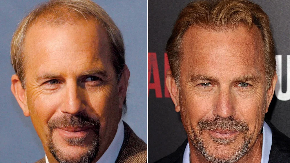 Die Spekulationen um das Kevin Costner Haare