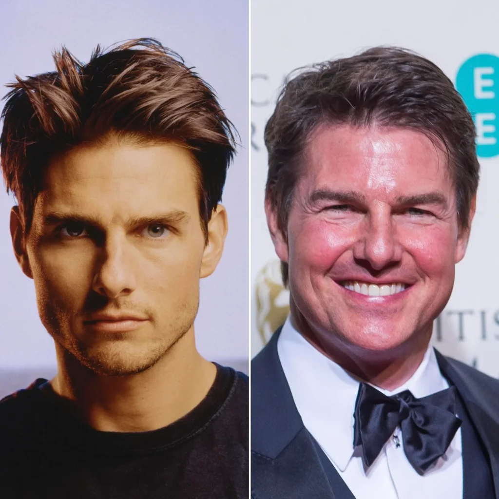 Tom Cruise Before and After: Unveiling the Changes in His Face