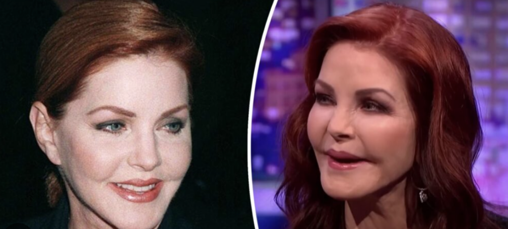 What Happened To Priscilla Presley's Face? Shocking Changes