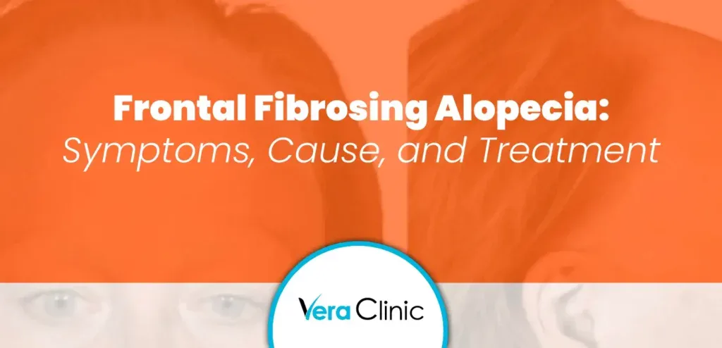 Frontal Fibrosing Alopecia