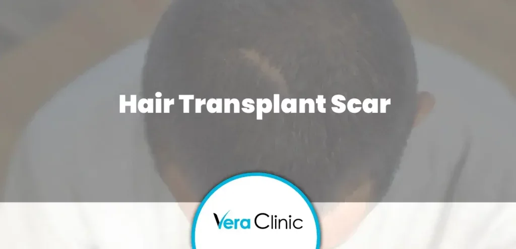 Hair Transplant Scar